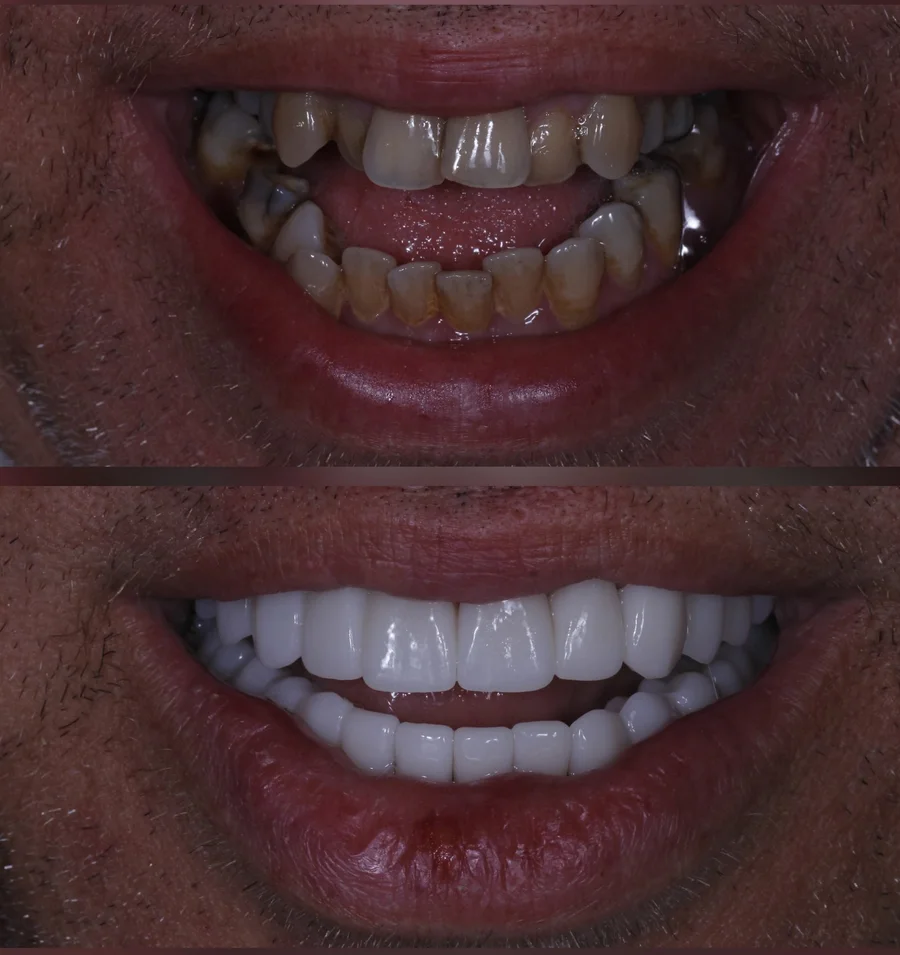 Before & After