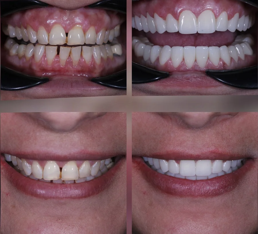 Before & After