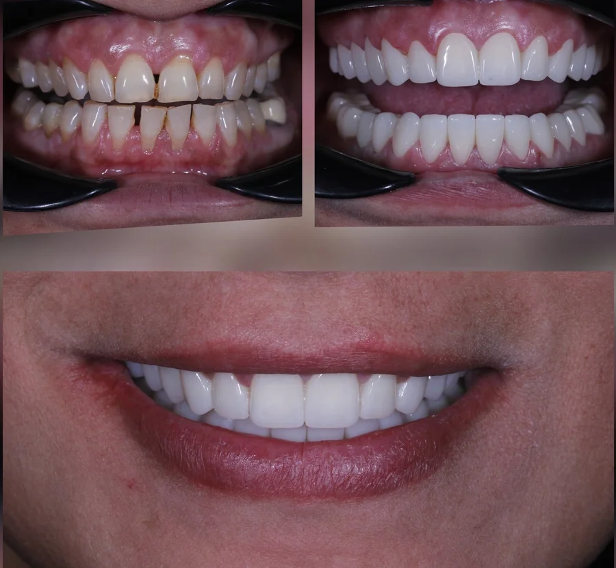 Before & After