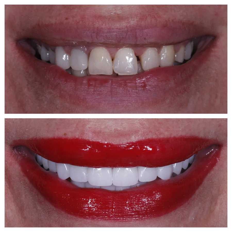 Before & After