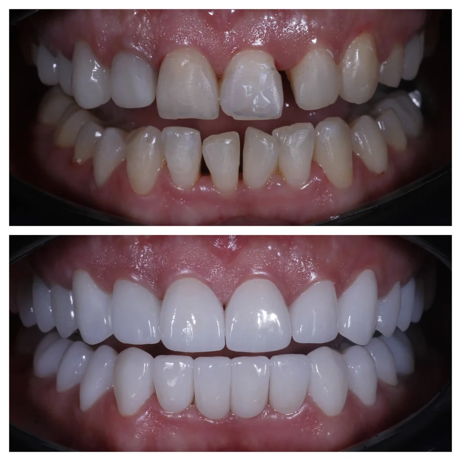 Before & After