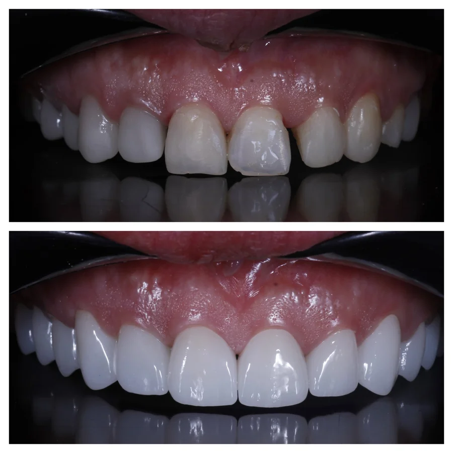 Before & After