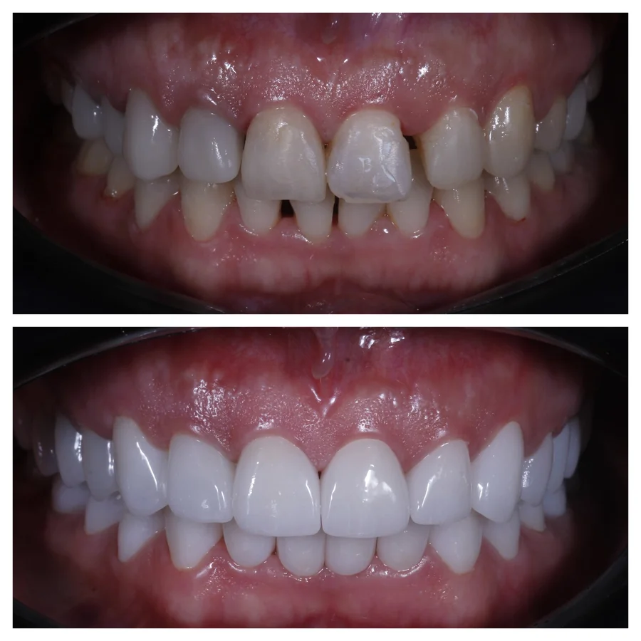 Before & After