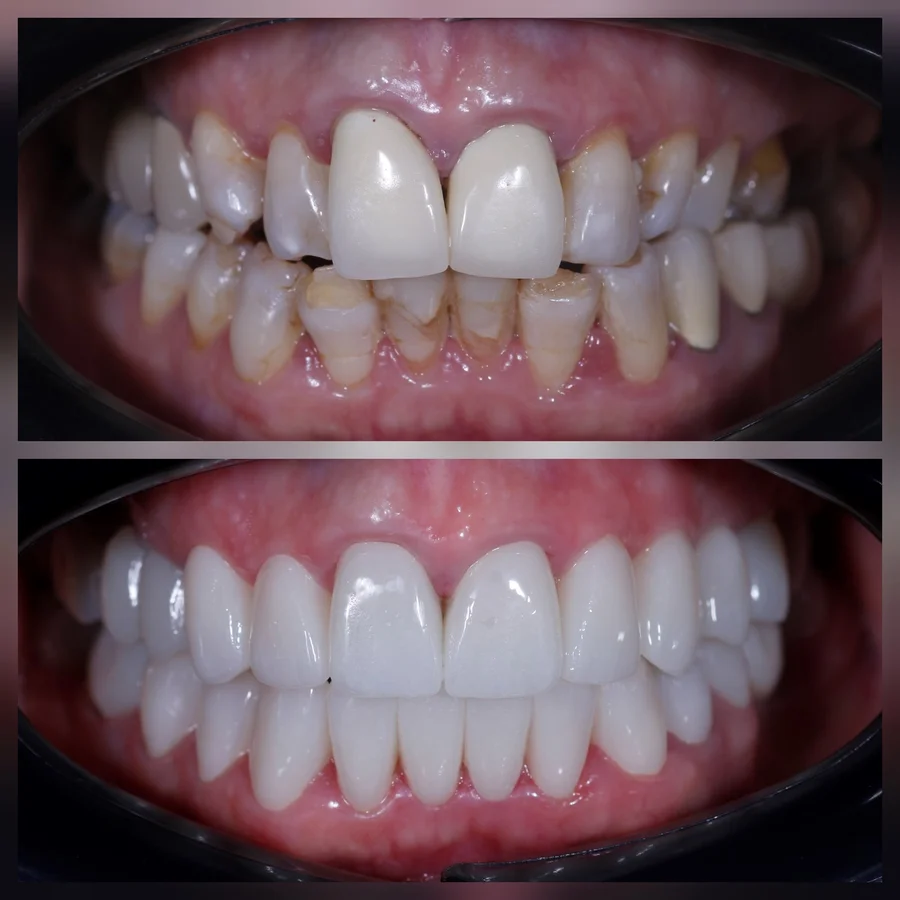 Before & After