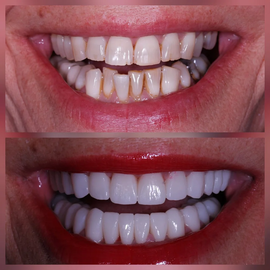 Before & After