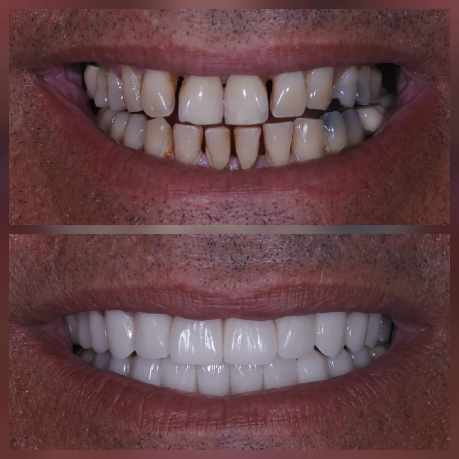 Before & After