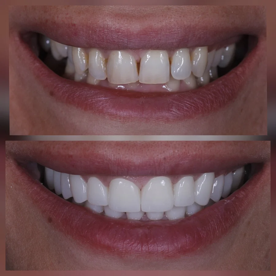 Before & After