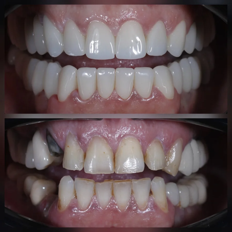 Before & After