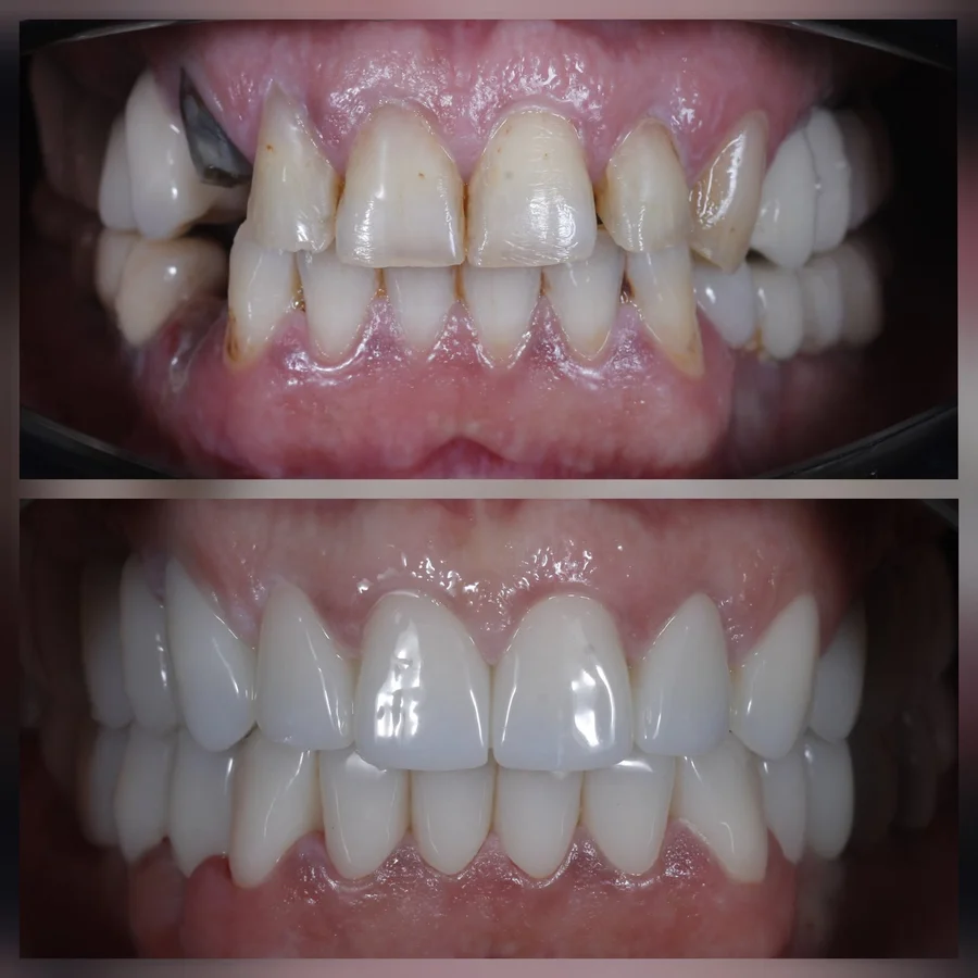 Before & After