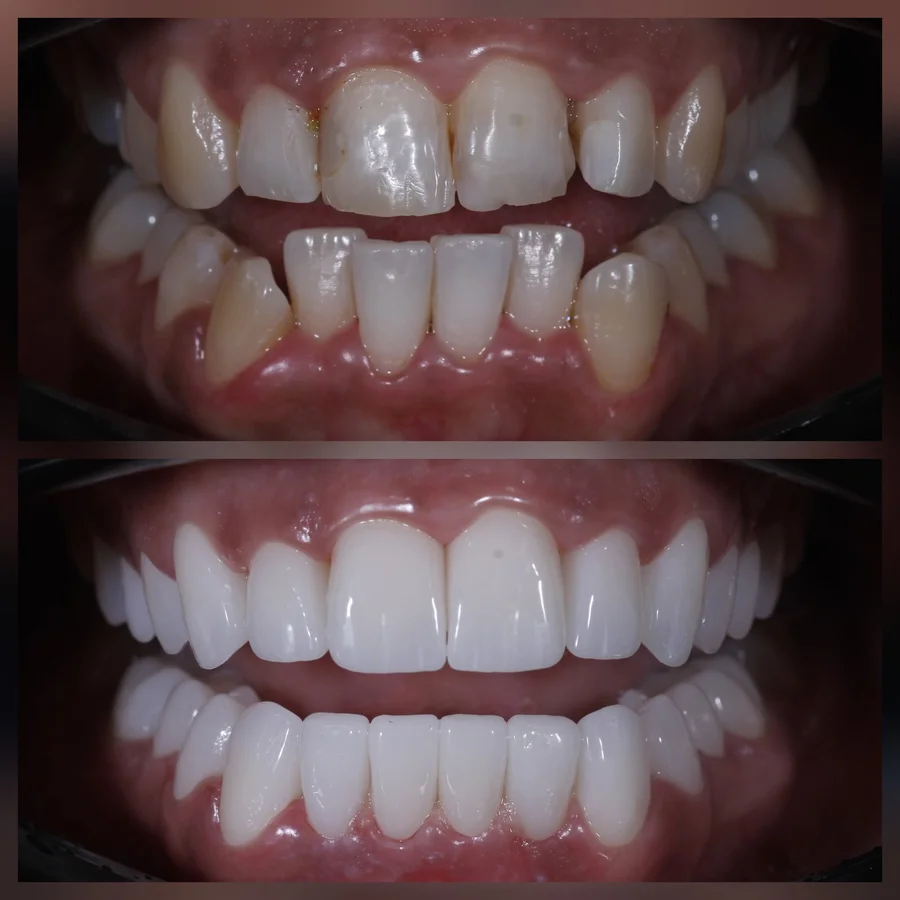 Before & After