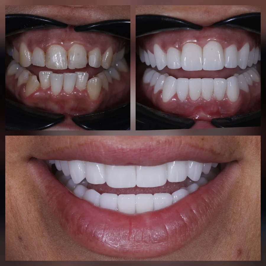 Before & After