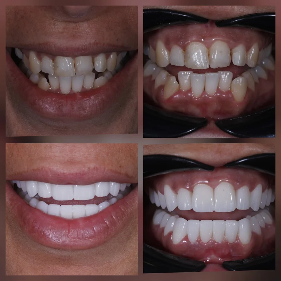Before & After