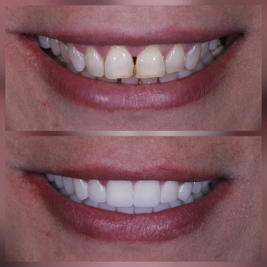 Before & After