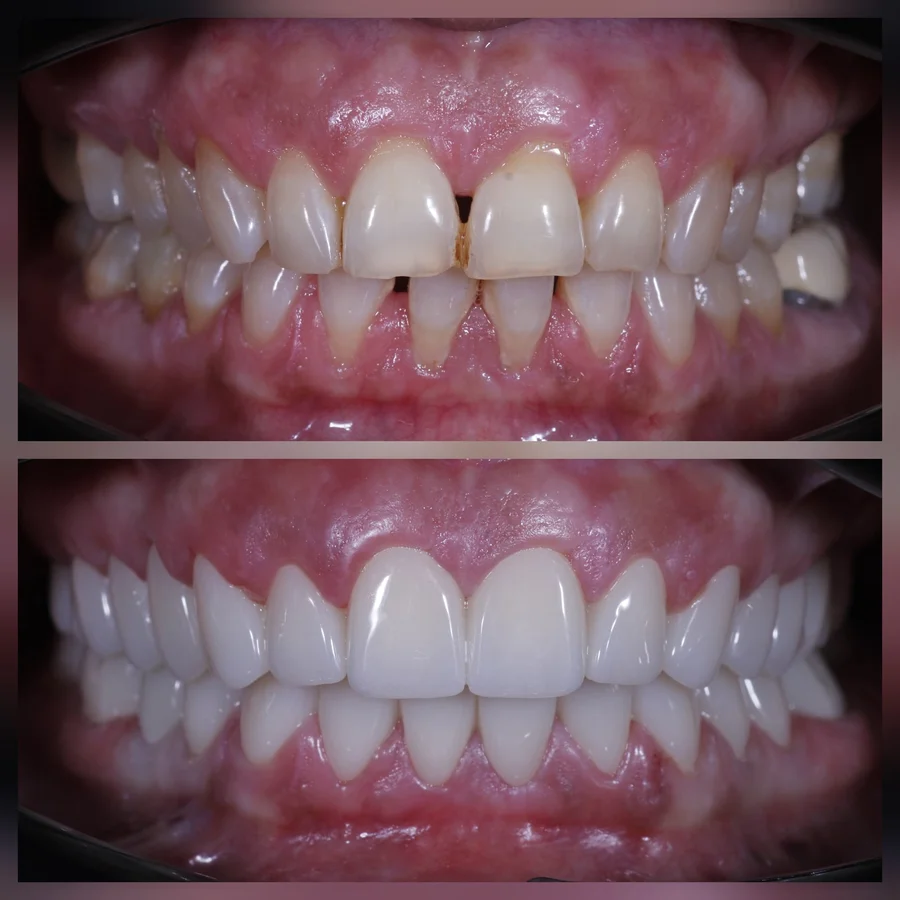 Before & After