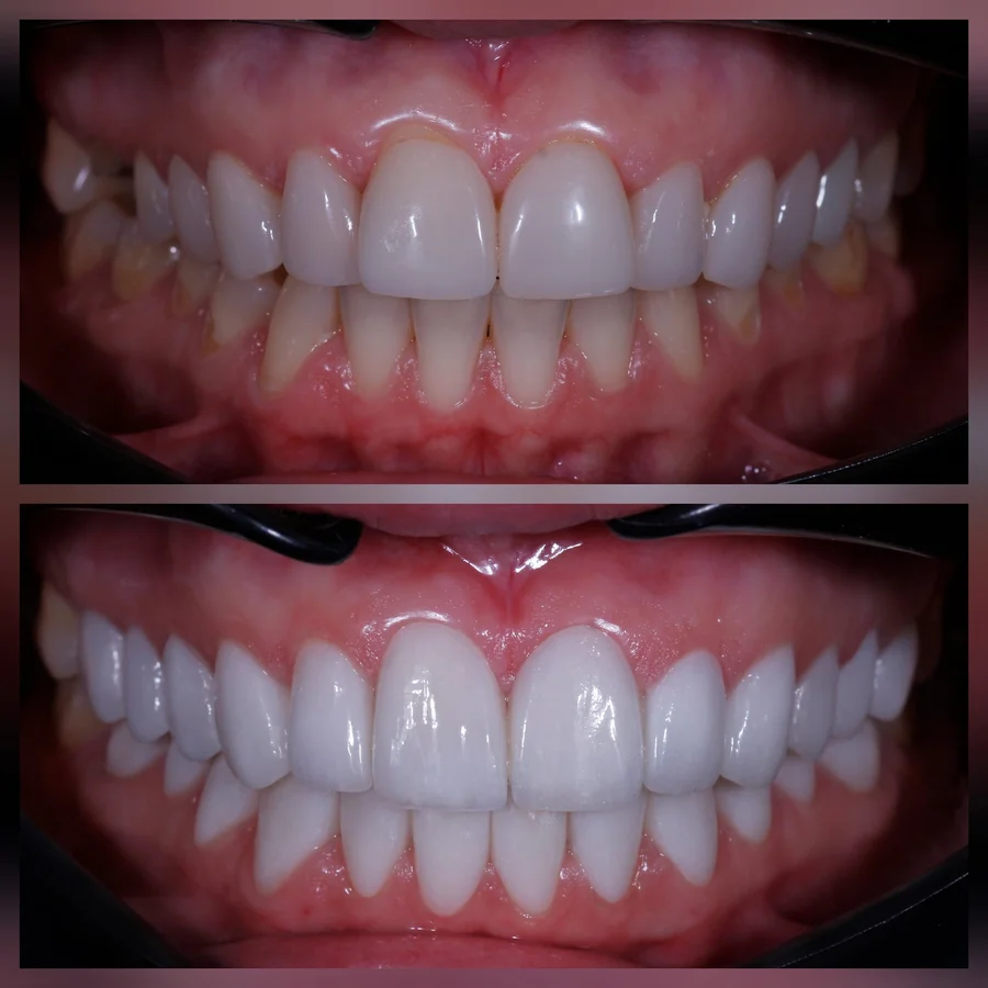 Before & After