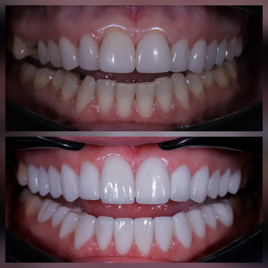 Before & After