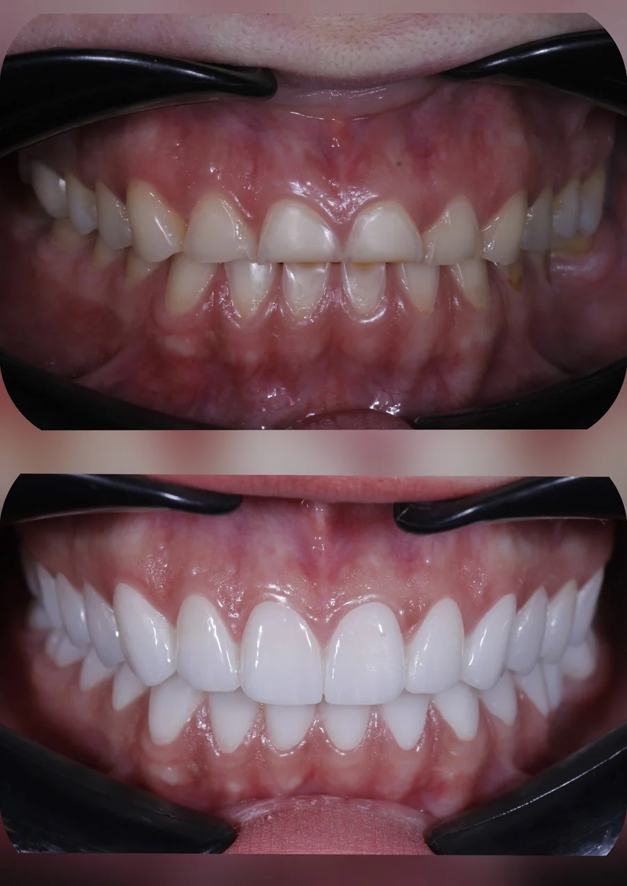 Before & After