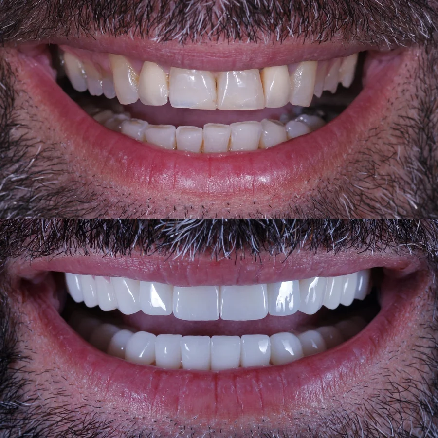 Before & After