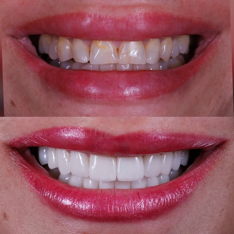 Before & After