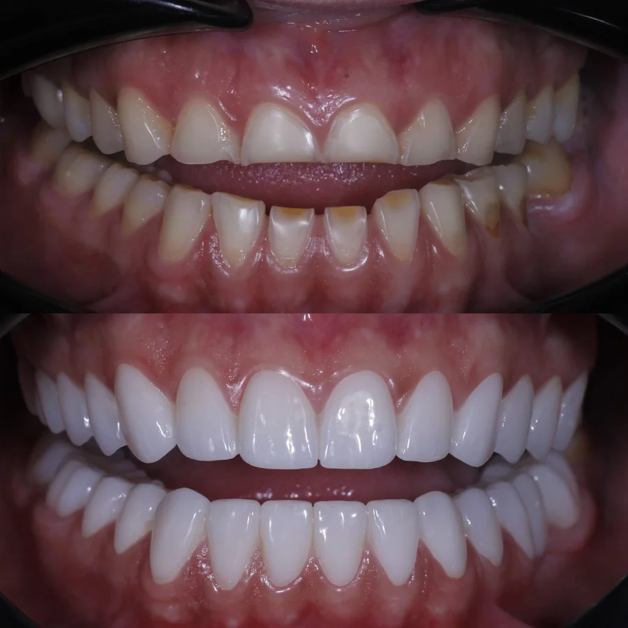 Before & After