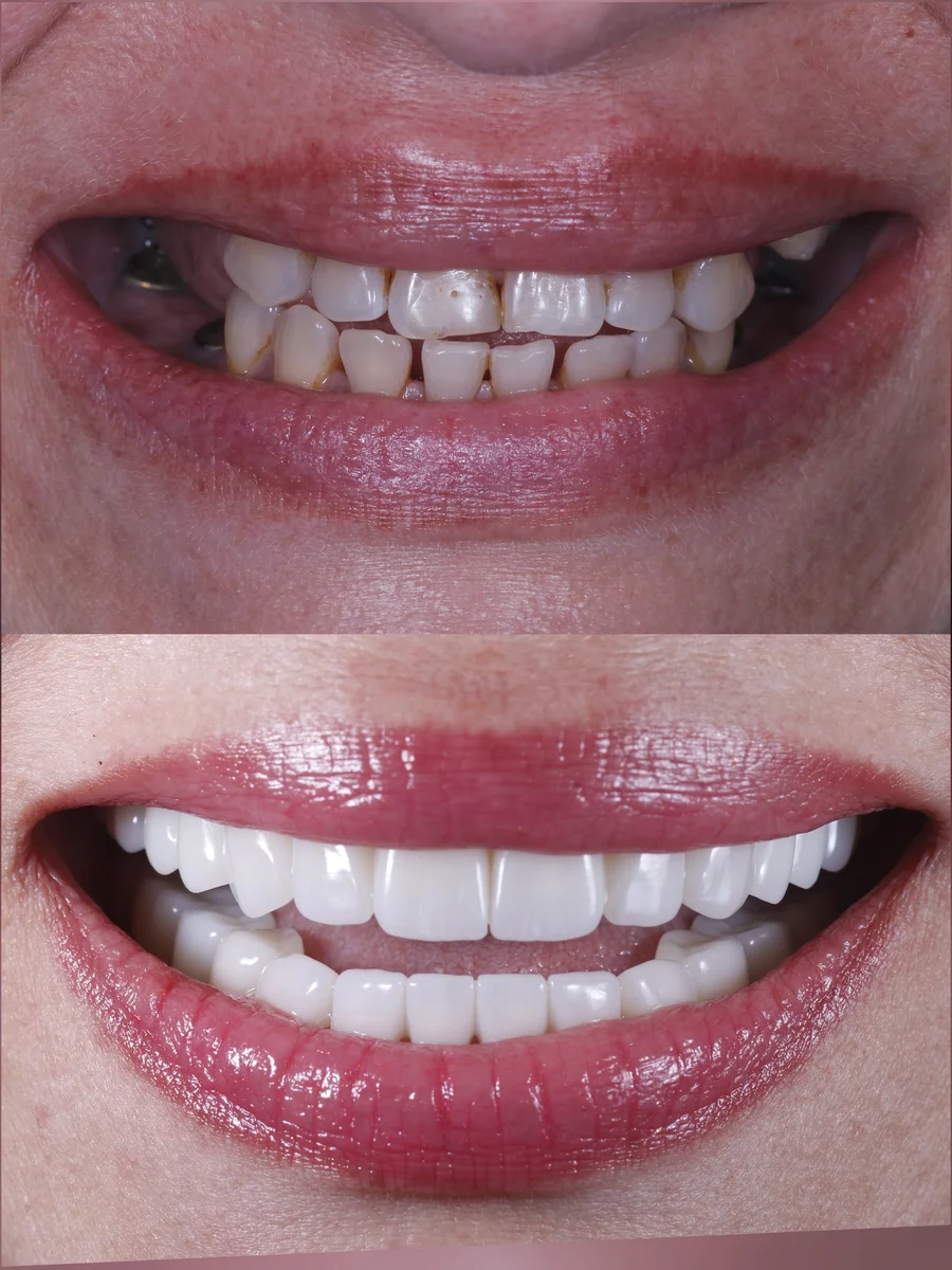 Before & After