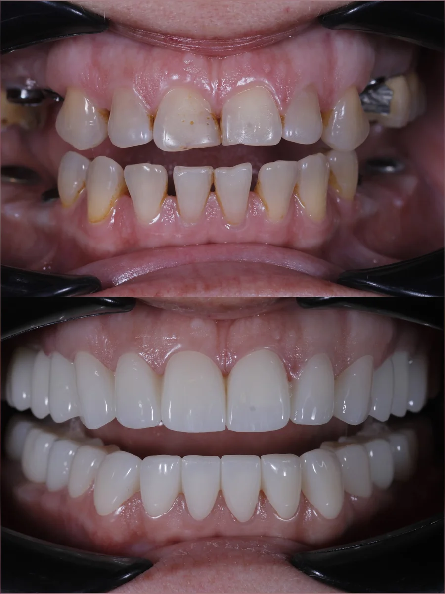 Before & After