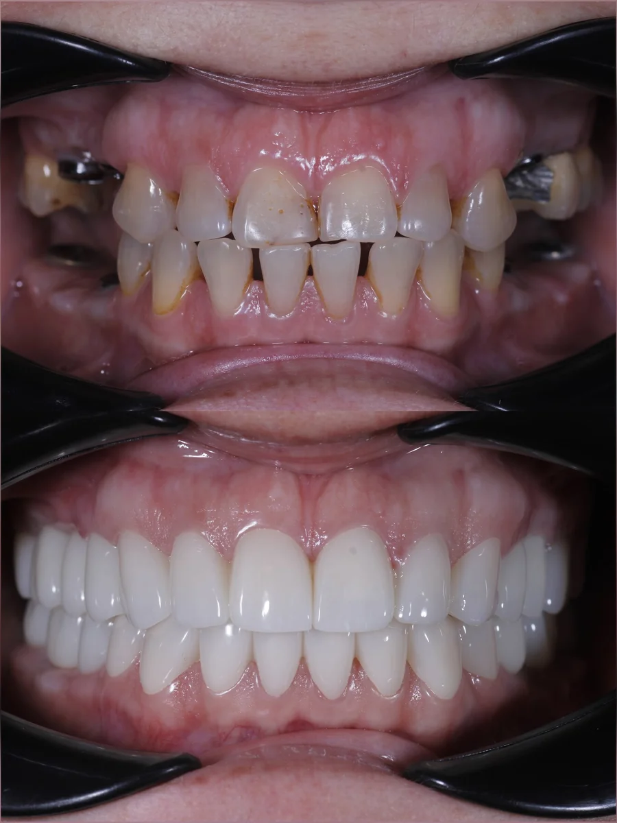Before & After