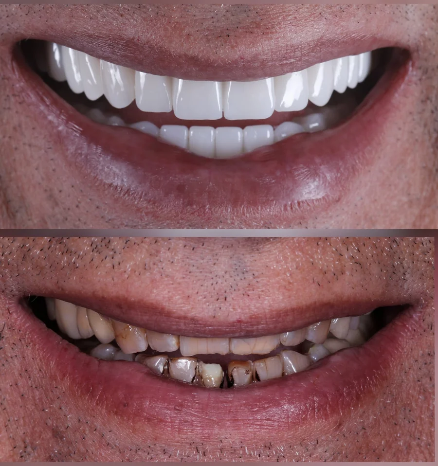 Before & After