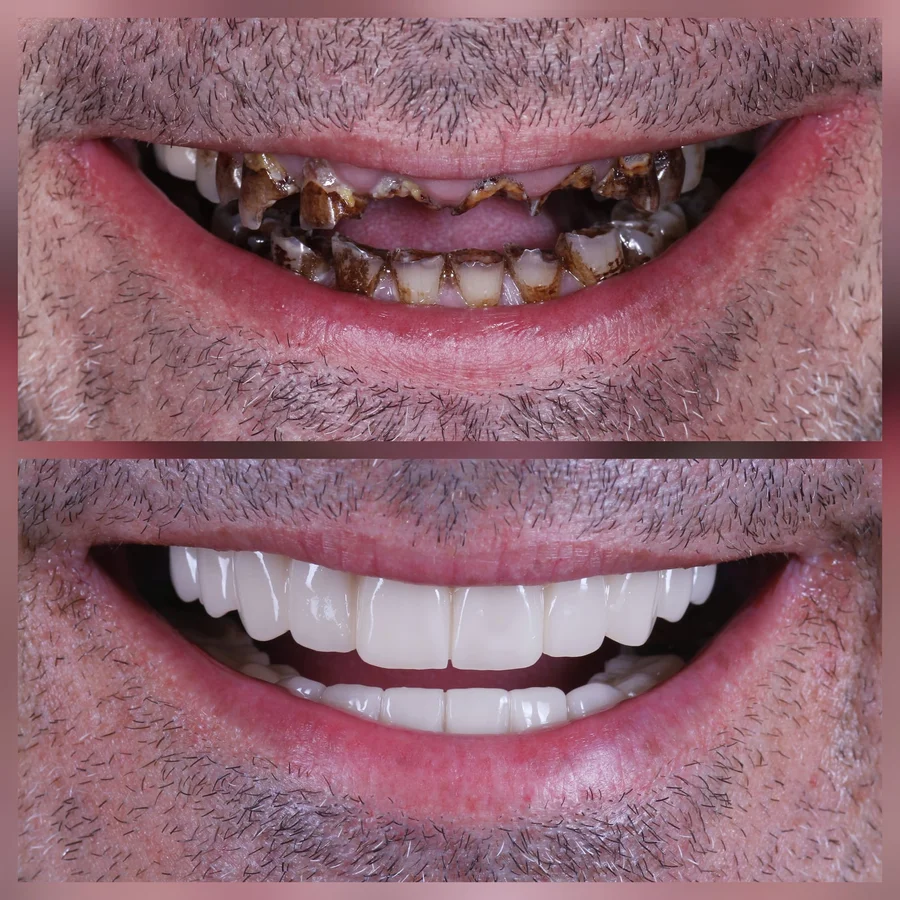 Before & After