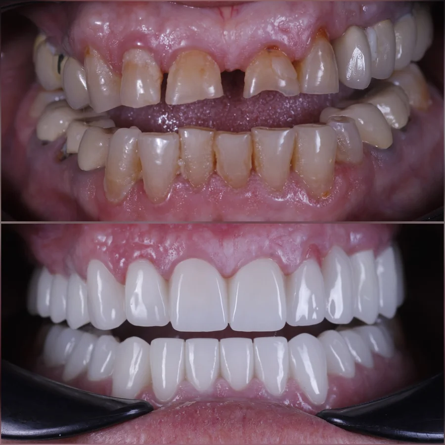 Before & After