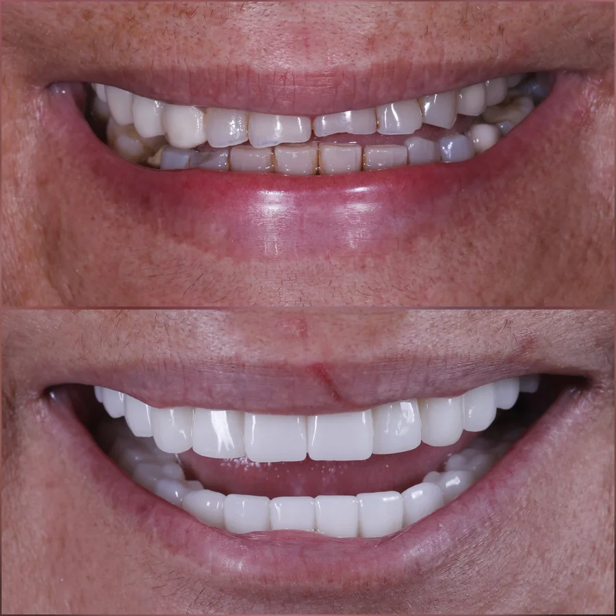 Before & After
