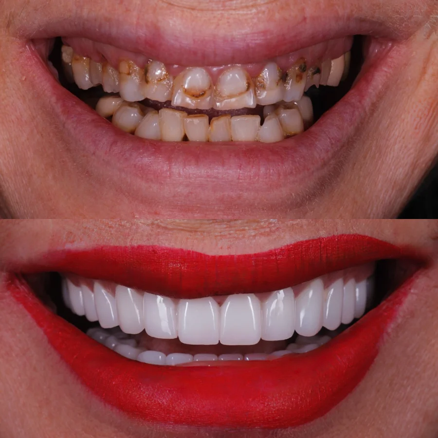 Before & After