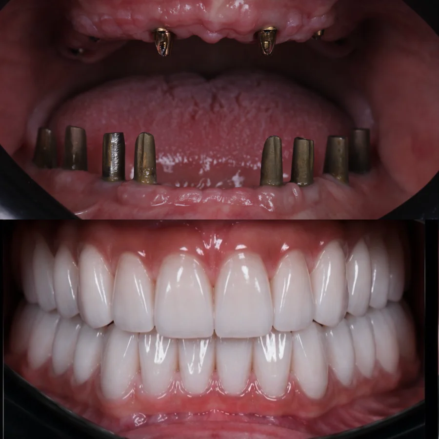 Before & After