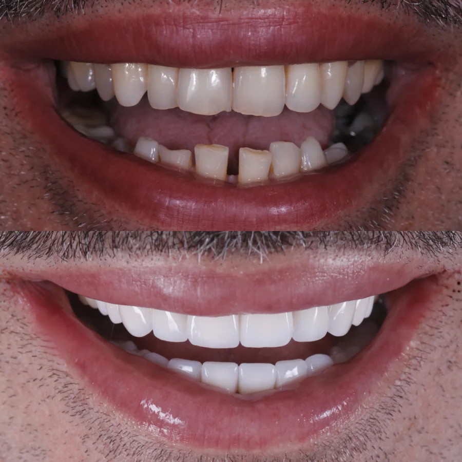 Before & After