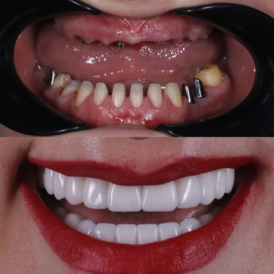 Before & After