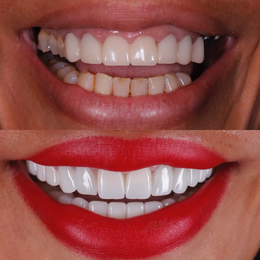 Before & After