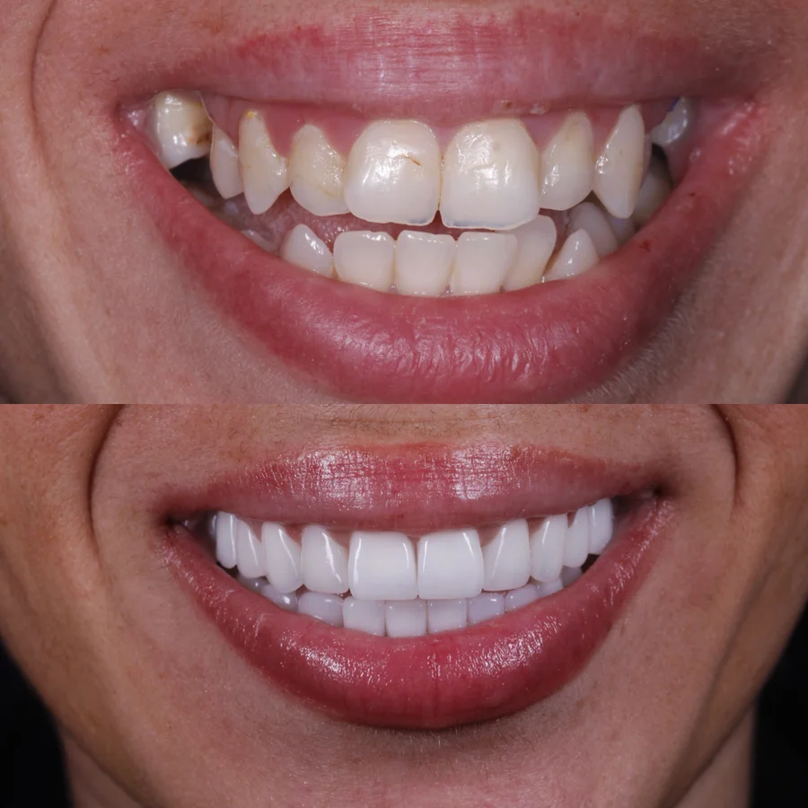 Before & After