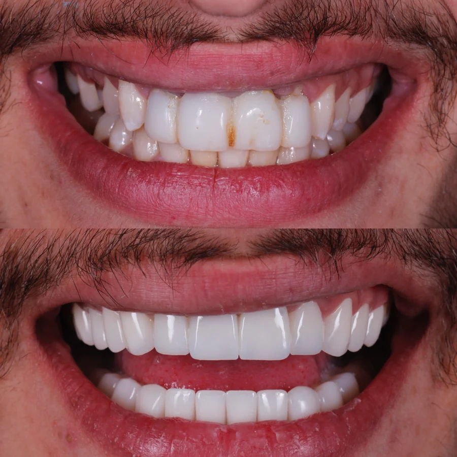 Before & After